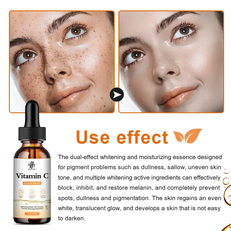 Сыворотка для лица с витамином С iMATCHME Осветляет кожу, осветляет пятна, Эссенция для лица с гиалуроновой кислотой, косметические средства по уходу за кожей Изображение 4