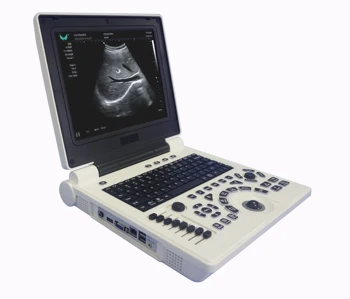 Дешевый ультразвуковой сканер BW с программным обеспечением THI PW 3D для человека или ветеринарии опционально